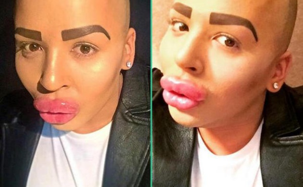 Le fan/sosie raté de Kim Kardashian est terrifié à l’idée que ses lèvres dégonflent