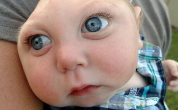 Miracle aux États-Unis : un bébé atteint ...,défie les pronostics des médecins(photos)