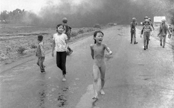 43 ans après, la petite fille vietnamienne brûlée au napalm tente de soigner ses blessures au laser
